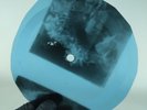 FRANK IFIELD I REMEMBER YOU X-Ray USSR Record Roentgen Bones Ribs Music Vinyl