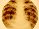 X-RAY USSR ROENTGEN BONES RECORD ORIGINAL OLD RIBS 868
