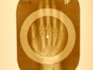 USSR X-RAY HAND ROENTGEN BONES RECORD ORIGINAL OLD RIBS 880