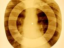 X-RAY USSR ROENTGEN BONES RECORD ORIGINAL OLD RIBS 882