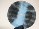 ROLLING STONES AROUND & AROUND X-Ray USSR Record Roentgen Bone Ribs Music Vinyl