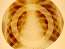 X-RAY USSR ROENTGEN BONES RECORD ORIGINAL OLD RIBS 942