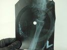 EDDIE COHRAN C-MON EVERYBODY X-Ray USSR Record Roentgen Bone Ribs Music Vinyl