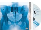 AUTOGRAPHED SIGNED Lorde VIRGIN GATEFOLD Presale X-Ray Picture Disc Vinyl LP