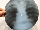 BOB DYLAN BALLAD OF A THIN MAN X-Ray USSR Record Roentgen Bone Ribs Music Vinyl