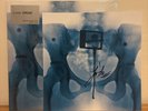 AUTOGRAPHED SIGNED Lorde VIRGIN GATEFOLD X-Ray Record Vinyl LP Factory Sealed