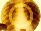 X-RAY USSR ROENTGEN BONES RECORD ORIGINAL OLD RIBS 37