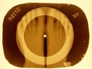 USSR X-RAY FOOTS ROENTGEN BONES RECORD ORIGINAL OLD RIBS 979