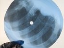 BEATLES NO REPLY X-Ray USSR Record Roentgen Bone Ribs Music Vinyl
