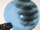 ELVIS GIRL OF MY BEST FRIEND X-Ray USSR Record Roentgen Bone Ribs Music Vinyl