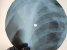 J CASH RING OF FIRE X-Ray USSR Record Roentgen Bone Ribs Music Vinyl