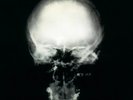 Ministry - The Mind is a Terrible Thing to Taste (Expanded Edition, Rocktober