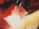 The Dream Syndicate ‎– Live At Raji's   dolp  topzustand