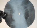 VELVET UNDERGROUND ROCK&ROLL X-Ray USSR Record Roentgen Bone Ribs Music Vinyl