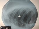 LED ZEPPELIN HEARTBREACKER X-Ray USSR Record Roentgen Bone Ribs Music Vinyl