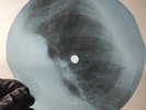 BEATLES ALL YOU NEED IS LOVE X-Ray USSR Record Roentgen Bone Ribs Music Vinyl