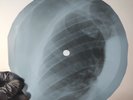 LED ZEPPELIN MOBY DICK X-Ray USSR Record Roentgen Bone Ribs Music Vinyl