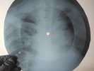 LED ZEPPELIN DAZED & CONFUSED X-Ray USSR Record Roentgen Bone Ribs Music Vinyl