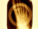 USSR X-RAY FOOT BONES RIBS SOVIET VINTAGE UNIQUE ITEM RECORD 22 FOLK