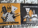 angine de poitrine live Lp