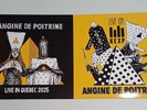ANGINE  DE POITRINE LIVE - 2 LP VINYL