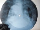ROLLING STONES SATISFACTION X-Ray USSR Record Roentgen Bone Ribs Music Vinyl