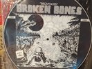 Broken Bones-Decapitated-vinyl picture disk - 1987 fallout records