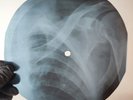NINA SIMONE SATIN DOLL X-Ray USSR Record Roentgen Bone Ribs Music Vinyl