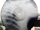 Rare Soviet X-Ray Bone RecordOriginal USSR Rib Disc – VintageMusic Artifact